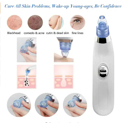 Electric Blackhead Remover Facial Cleansing Device Frezze_Luxe