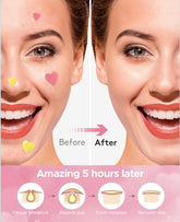 LitBear 3 IN 1 Acne Patch for Face 7 Sizes 368 Patches Hydrocolloid Acne Patches for Chin Forehead Nose 16 XL Pimple Patches Large for Body Heart-Shaped Acne Cover Zit Patches Acne Dots Sticker Frezze_Luxe