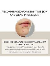 Skin1004 Madagascar  100 Ampoule (100ml or 3.38 floz) / Facial Serum / 100% Centella Asiatica Extract/For soothing sensitive and acne-prone skin Frezze_Luxe