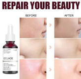 Skin Refining Serum Anavell