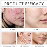 Glycolic Acid Exfoliating Pads Frezze_Luxe